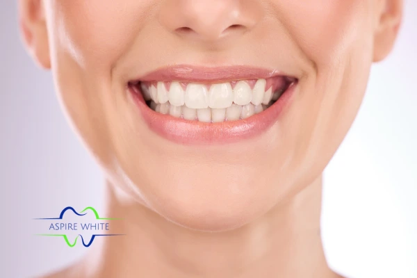 Follow your teeth whitening aftercare England to prolong your whiter smile!