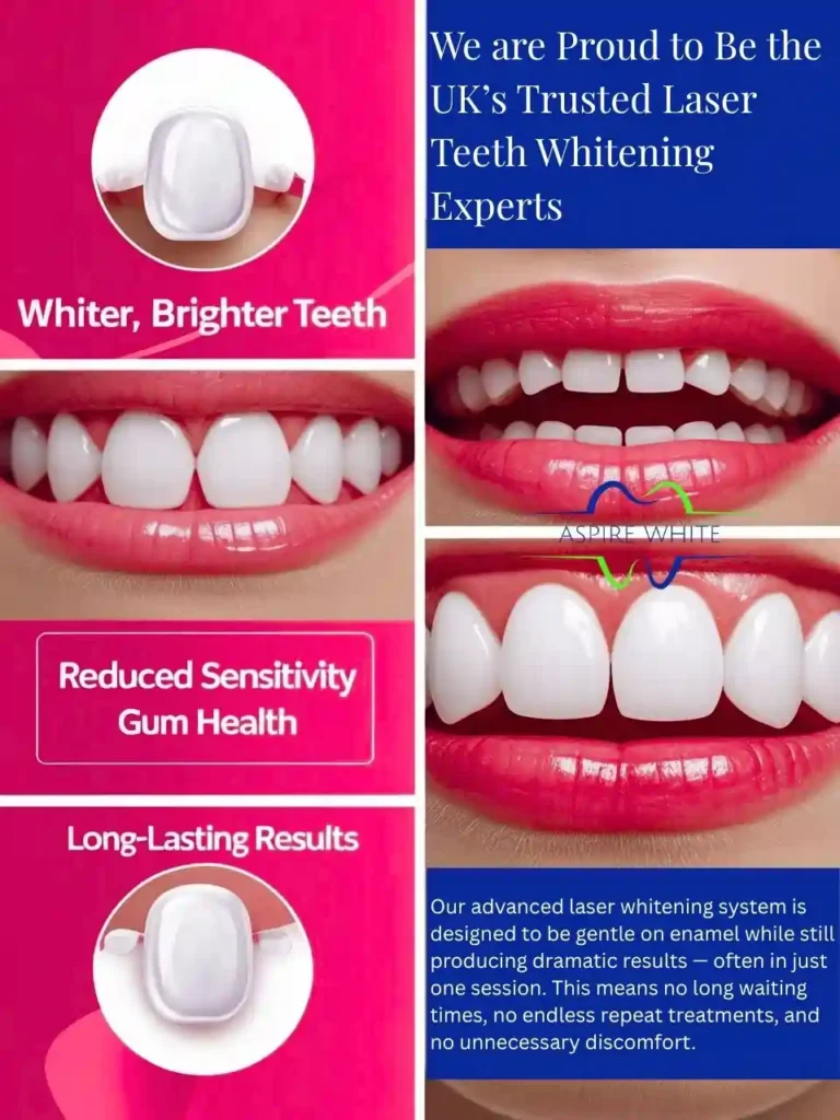 We are Proud to Be the UK’s Trusted Laser Teeth Whitening Experts England